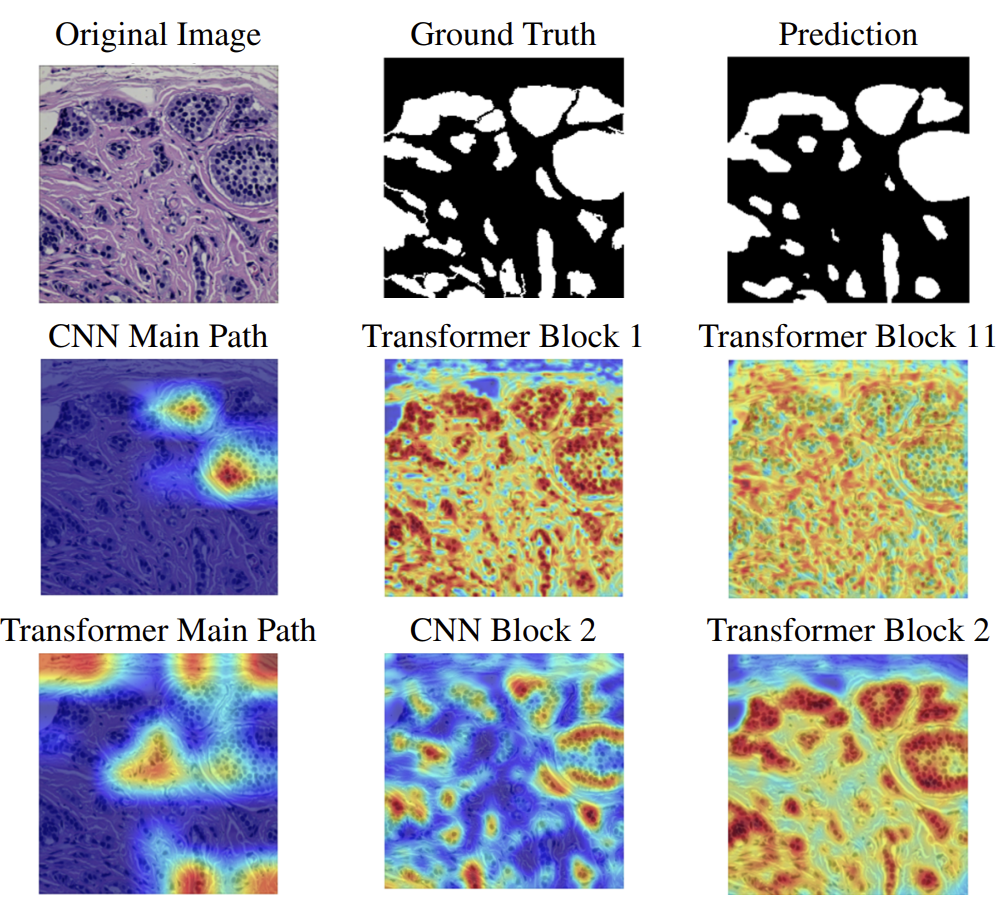 Explainability Visualization