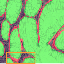 Test A TransUNet Overlay