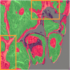 Test B TransUNet Overlay